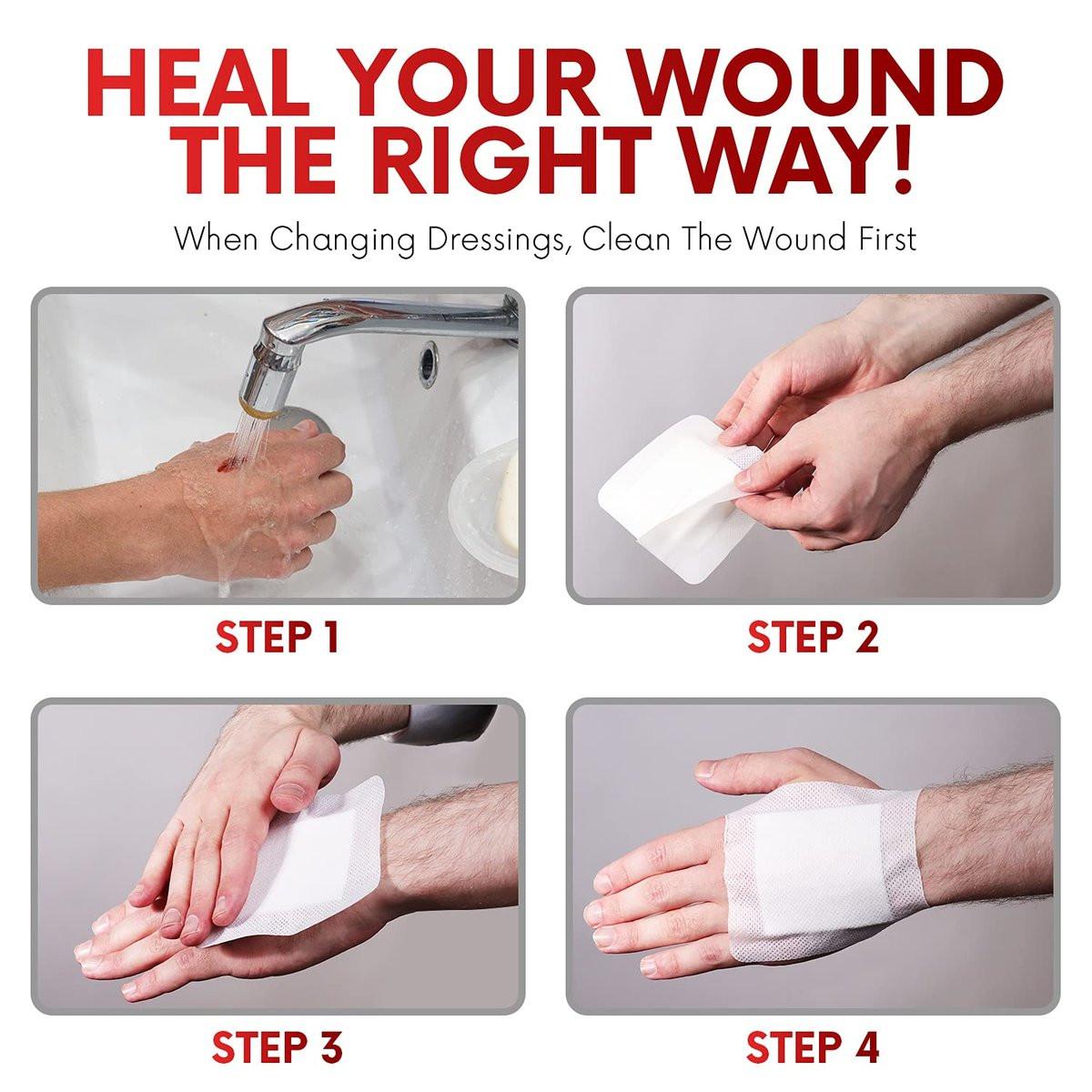 HEALQU Bordered Gauze Island Dressing – 50 Stück, 2" x 2" sterile, einzeln verpackte Gaze-Pads mit wasserabweisender, nicht gewebter Rückseite – weiche und atmungsaktive Wundauflage für Erste Hilfe und medizinische Anwendungen