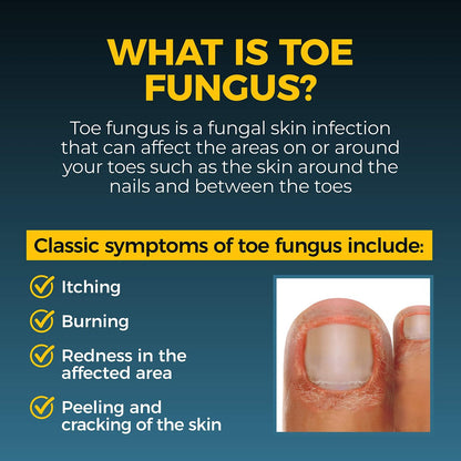 Fungi-Nail Anti-Pilz-Liquid-Lösung, 1 Unze (2er-Pack) – Wirksame Nagelpilzbehandlung mit Tolnaftat
