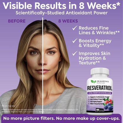 Extra Starkes Resveratrol 1568 mg – 180 Kapseln – 3 Monate Vorrat | Antioxidans Nahrungsergänzungsmittel | Natürliche Trans-Resveratrol-Pillen | Für Anti-Aging, Herzgesundheit, Immunsystem & Gehirnfunktion