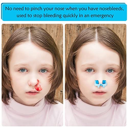 16-teiliges Nasenklammer-Set gegen Nasenbluten – Epistaxis-Clip aus Kunststoff mit Schaumstoff für Erwachsene in Notfällen