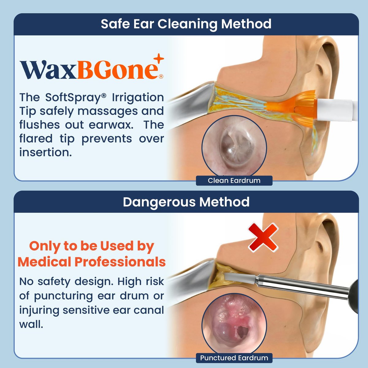WaxBGone® Ohrenschmalz-Entfernungsset mit SoftSpray®-Spülaufsätzen – Sicheres, sanftes und schnelles Ohrenreinigungsset für Erwachsene und Kinder zu Hause – Standard-Set mit Ohrentropfen