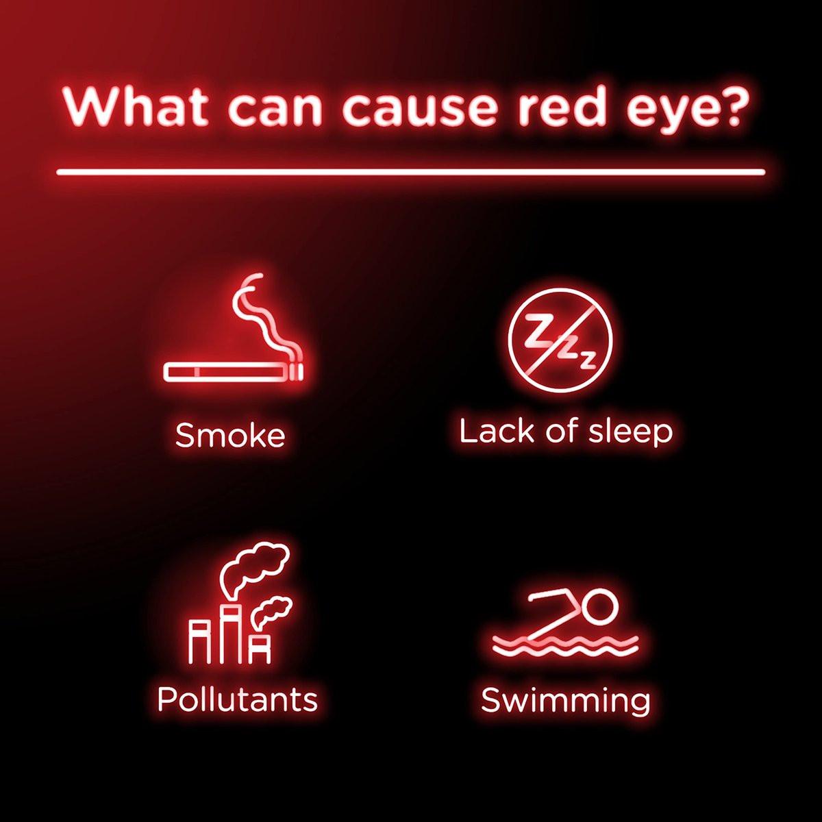 Visine Red Eye Comfort – Schnelle Linderung bei geröteten Augen durch leichte Reizungen, Tetrahydrozolin HCl, 15 ml