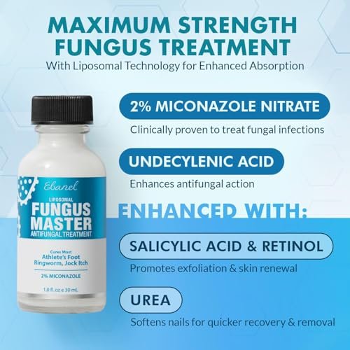 Ebanel Antimykotikum Creme mit Miconazol gegen Fußpilz, Nagelpilz, Juckreiz und Ringelflechte – 60 ml