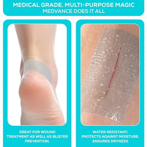 MedVance Silikonband 5 cm breit, weich mit Perforation und zuschneidbar (1 Packung, 1,4 m)