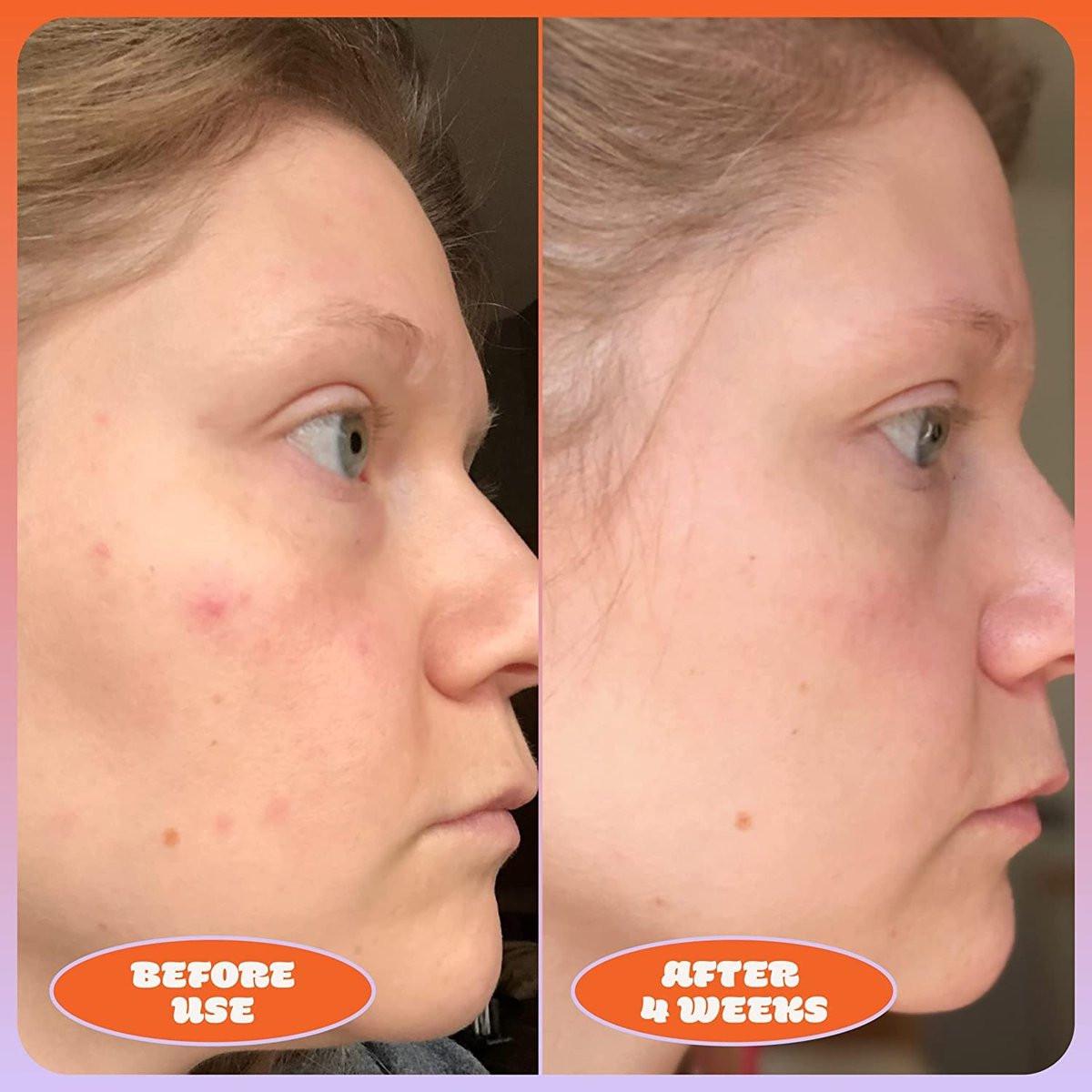 Blume Milky Fade Vitamin C Serum für das Gesicht - Dunkelfleck-Korrektor mit Niacinamid, Hyaluronsäure & Vitamin E - Beruhigt den Hautton - Veganes & tierversuchsfreies Feuchtigkeitsserum (30 ml)