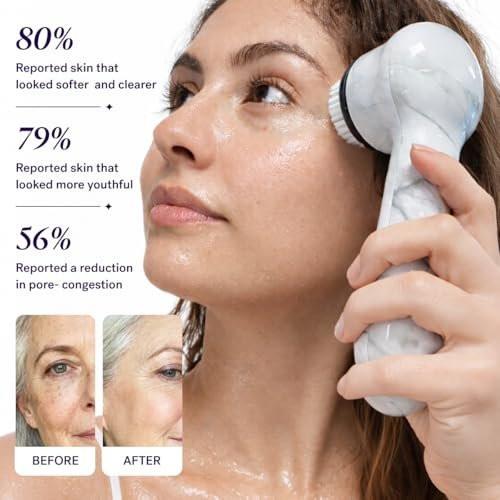 Michael Todd Beauty Soniclear Allure 2024 Best of Beauty Winner - Gesichtsreinigungs- und Peelingbürstensystem mit antimikrobiell geschützten Borsten, 4 Geschwindigkeiten, Serum-Infusion-Aufsatz und Reiseetui