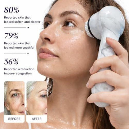 Michael Todd Beauty Soniclear Allure 2024 Best of Beauty Winner - Gesichtsreinigungs- und Peelingbürstensystem mit antimikrobiell geschützten Borsten, 4 Geschwindigkeiten, Serum-Infusion-Aufsatz und Reiseetui