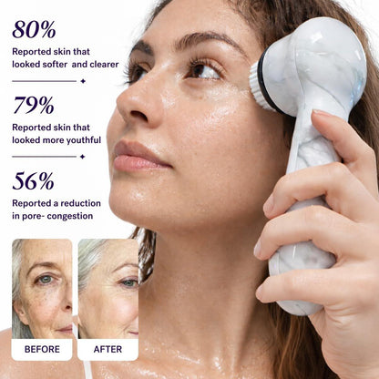 Michael Todd Beauty Soniclear Allure 2024 Best of Beauty Winner - Gesichtsreinigungs- und Peelingbürstensystem mit antimikrobiell geschützten Borsten, 4 Geschwindigkeiten, Serum-Infusion-Aufsatz und Reiseetui