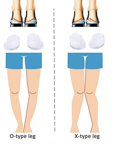 Orthopädische Einlegesohlen 4 Paar – Silikon Fersenkeile für Männer und Frauen, Korrektur von Pronation und Supination, O/X-Bein-Korrektur (Transparent)