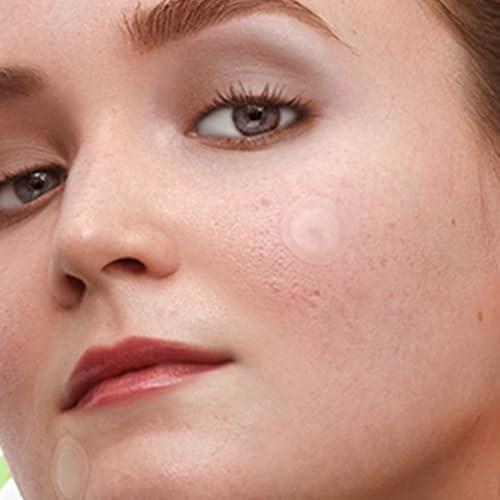 PEACE OUT Microneedling Dots für das Gesicht – Gezielte Spot-Patches mit auflösenden Mikronadeln, Niacinamid, Hydrokolloid zur Verbesserung von unebenem Hautton und -textur (12 Stück)