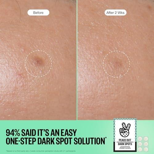 PEACE OUT Microneedling Dots für das Gesicht – Gezielte Spot-Patches mit auflösenden Mikronadeln, Niacinamid, Hydrokolloid zur Verbesserung von unebenem Hautton und -textur (12 Stück)