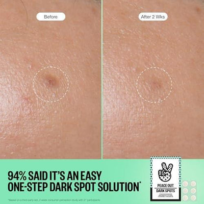 PEACE OUT Microneedling Dots für das Gesicht – Gezielte Spot-Patches mit auflösenden Mikronadeln, Niacinamid, Hydrokolloid zur Verbesserung von unebenem Hautton und -textur (12 Stück)