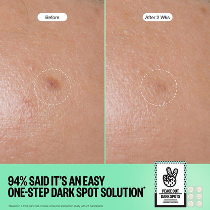 PEACE OUT Microneedling Dots für das Gesicht – Gezielte Spot-Patches mit auflösenden Mikronadeln, Niacinamid, Hydrokolloid zur Verbesserung von unebenem Hautton und -textur (12 Stück)