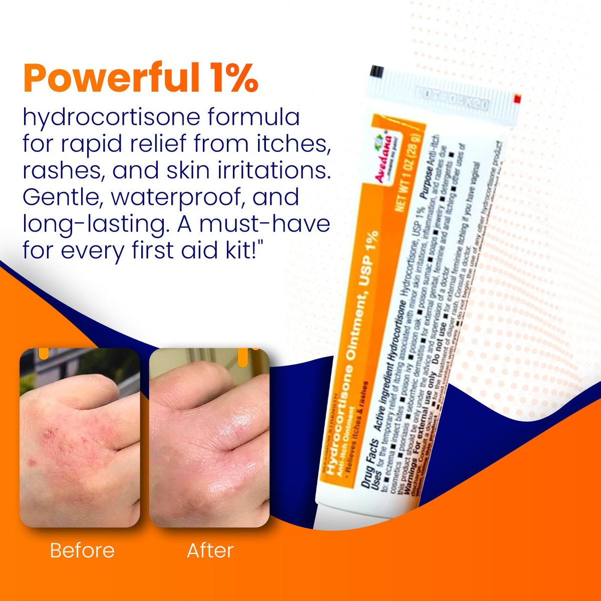 AVEDANA Hydrocortison Salbe 1% USP Maximale Stärke - 1oz Anti-Juckreiz Salbe für schnelle Linderung - Beruhigende und kühlende wasserfeste Formel mit Aloe Vera