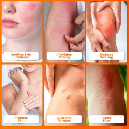 AVEDANA Hydrocortison Salbe 1% USP Maximale Stärke - 1oz Anti-Juckreiz Salbe für schnelle Linderung - Beruhigende und kühlende wasserfeste Formel mit Aloe Vera