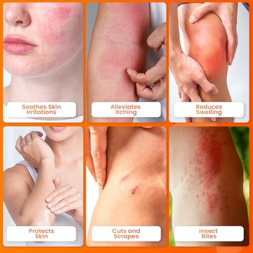 AVEDANA Hydrocortison Salbe 1% USP Maximale Stärke - 1oz Anti-Juckreiz Salbe für schnelle Linderung - Beruhigende und kühlende wasserfeste Formel mit Aloe Vera