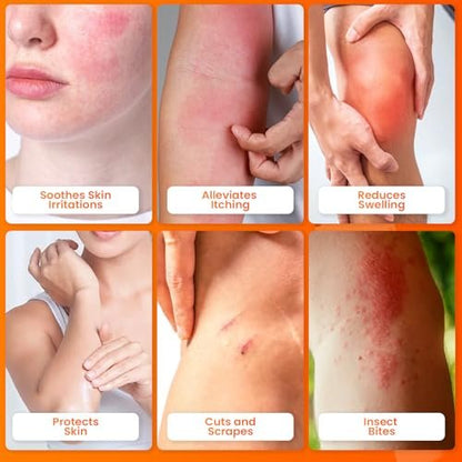 AVEDANA Hydrocortison Salbe 1% USP Maximale Stärke - 1oz Anti-Juckreiz Salbe für schnelle Linderung - Beruhigende und kühlende wasserfeste Formel mit Aloe Vera