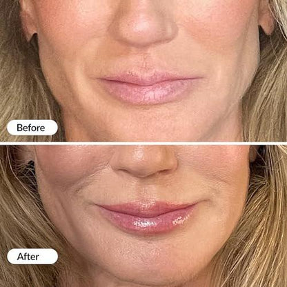 Vibriance Feuchtigkeitsspendender Lippen-Volumizer - Plumping Gloss mit Hyaluronsäure - Glättet Linien und Fältchen, 0,14 fl oz
