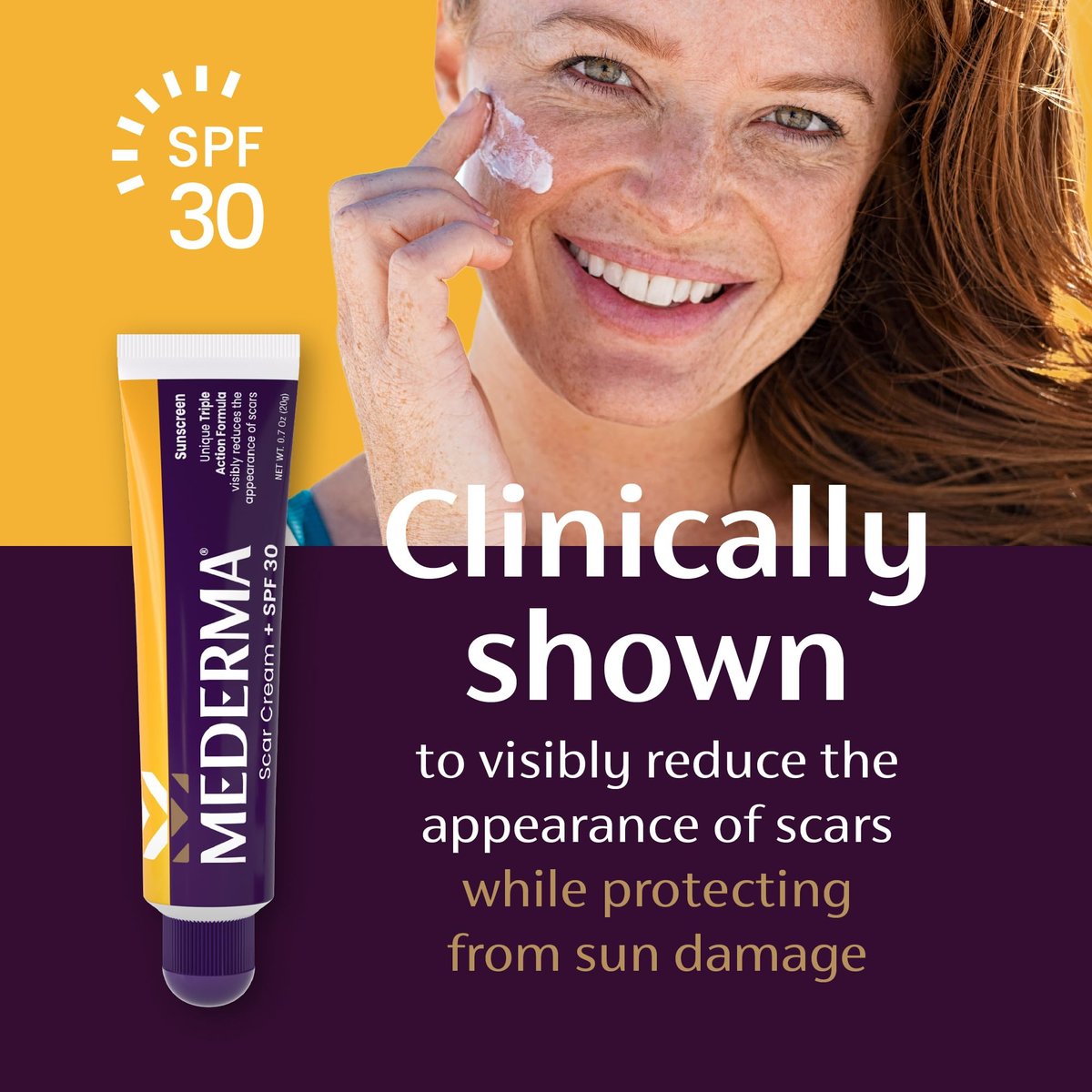 Mederma Narbencreme Plus SPF 30 - Fortschrittliche Narbenbehandlung, schützt vor Sonnenschäden, reduziert das Erscheinungsbild von Narben durch Akne, Verbrennungen, Operationen & Verletzungen, 20 g