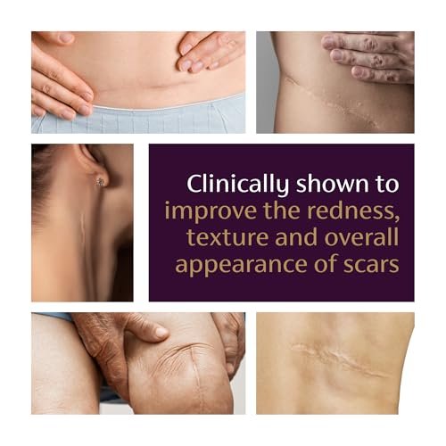Mederma Advanced Scar Gel – Reduziert das Erscheinungsbild von alten und neuen Narben, Aknenarben, Operationsnarben, Verbrennungen, Verletzungen und Dehnungsstreifen, 20 g