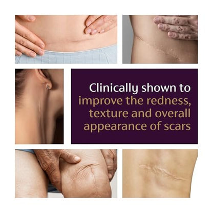 Mederma Advanced Scar Gel – Reduziert das Erscheinungsbild von alten und neuen Narben, Aknenarben, Operationsnarben, Verbrennungen, Verletzungen und Dehnungsstreifen, 20 g