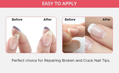 Professionelles Nagelreparaturset für gebrochene, gespaltene, rissige und schwache Nägel – Einfach anzuwenden – Schnelle Lösung