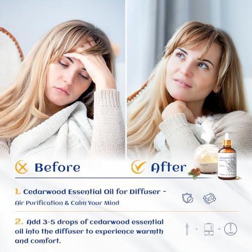 HIQILI 30 ml Zedernholz ätherisches Öl, 100% rein natürlich – für Haare, Diffuser & Aromatherapie