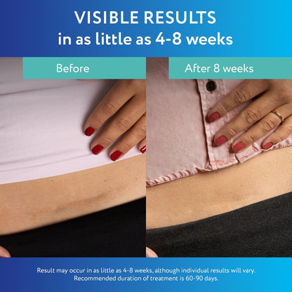 ScarAway Advanced Clear Silicone Scar Sheets - Medizinische Silikonpflaster (1,5" x 3") zur Narbenbehandlung und -prävention für chirurgische, Verbrennungs-, Körper-, hypertrophe und Keloidnarben, 10 klare Blätter