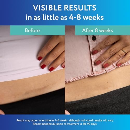 ScarAway Advanced Clear Silicone Scar Sheets - Medizinische Silikonpflaster (1,5" x 3") zur Narbenbehandlung und -prävention für chirurgische, Verbrennungs-, Körper-, hypertrophe und Keloidnarben, 10 klare Blätter