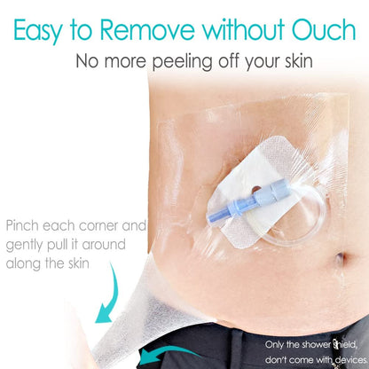 Hola Health Wasserdichte Duschabdeckung für Dialyse-Port, PICC-Leitung, Chemo-Port, Ernährungssonde – 25er-Pack, 20 x 20 cm