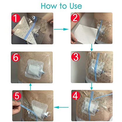 Wasserdichte Duschabdeckung mit nicht haftendem Mittelpad – 25 Stück, 15x15 cm für Dialyse-Ports, PICC-Leitung, Thoraxkatheter, Peritonealdialyse, Chemo-Sonde, PEG-Sonde, G-Sonde, Patientenverbandschutz