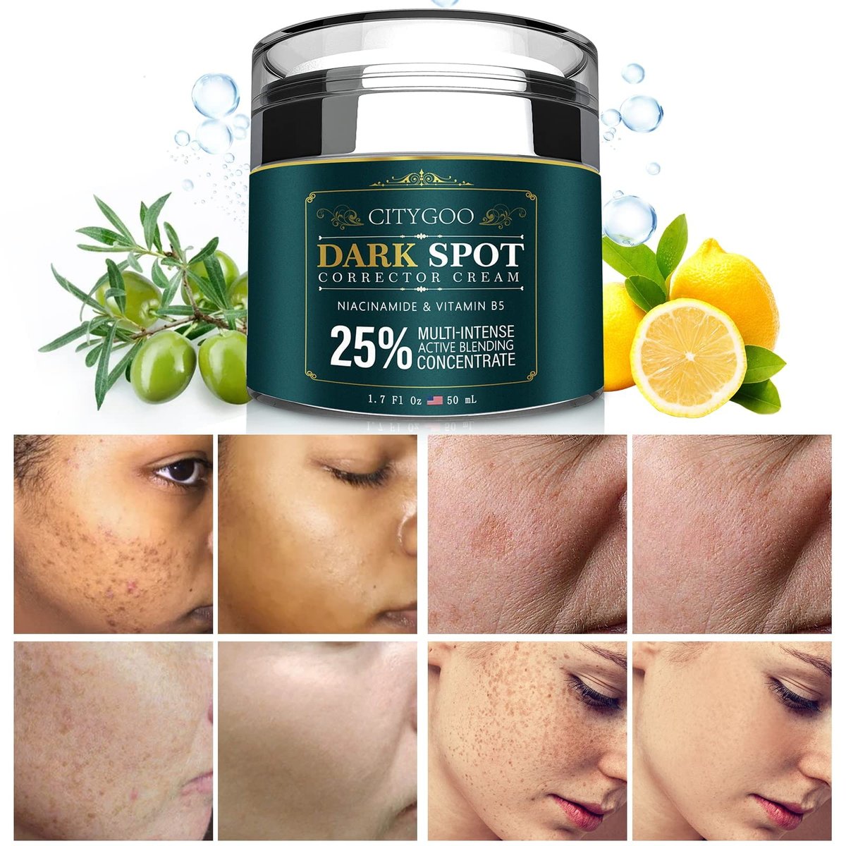 CITYGOO Dunkelheitsentferner für das Gesicht: Anti-Flecken Creme - Aufhellende Hautpflege für alle Hauttöne - Melasma-, Sommersprossen- und Sonnenfleckenentferner & Rötungsreduzierer - 50 ml