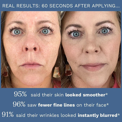 City Beauty Line-Blurring Wrinkle Filler – Spot-Behandlung gegen Falten & feine Linien – Glatte, gestraffte & hydratisierte Haut für Gesicht & Hals – Reine Formel mit Peptiden & Diamantpulver