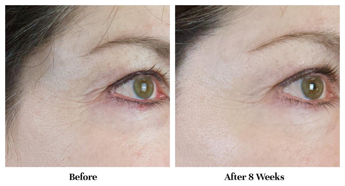 City Beauty Line-Blurring Wrinkle Filler – Spot-Behandlung gegen Falten & feine Linien – Glatte, gestraffte & hydratisierte Haut für Gesicht & Hals – Reine Formel mit Peptiden & Diamantpulver
