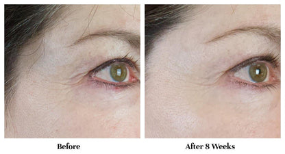 City Beauty Line-Blurring Wrinkle Filler – Spot-Behandlung gegen Falten & feine Linien – Glatte, gestraffte & hydratisierte Haut für Gesicht & Hals – Reine Formel mit Peptiden & Diamantpulver