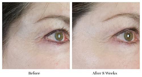 City Beauty Line-Blurring Wrinkle Filler – Spot-Behandlung gegen Falten & feine Linien – Glatte, gestraffte & hydratisierte Haut für Gesicht & Hals – Reine Formel mit Peptiden & Diamantpulver
