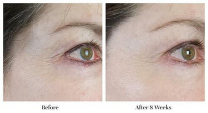 City Beauty Line-Blurring Wrinkle Filler – Spot-Behandlung gegen Falten & feine Linien – Glatte, gestraffte & hydratisierte Haut für Gesicht & Hals – Reine Formel mit Peptiden & Diamantpulver