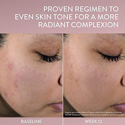Cetaphil Healthy Radiance Antioxidant-C Serum – Vitamin C Serum für empfindliche Haut, reduziert dunkle Flecken und Hyperpigmentierung, 30 ml