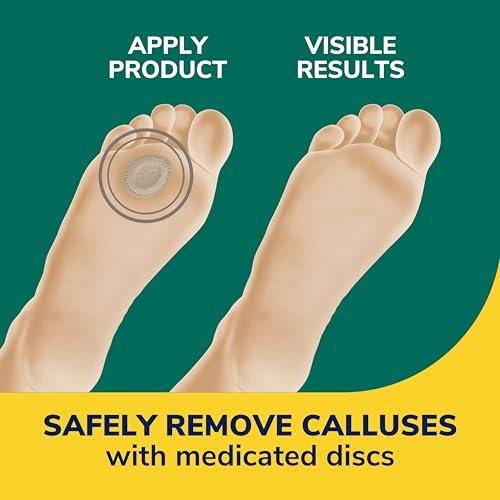 Dr. Scholl's Extra Dicke Hornhautentferner, 4 Stück // Hilft, harte Hornhaut zu erweichen und polstert für ganztägige Schmerzlinderung