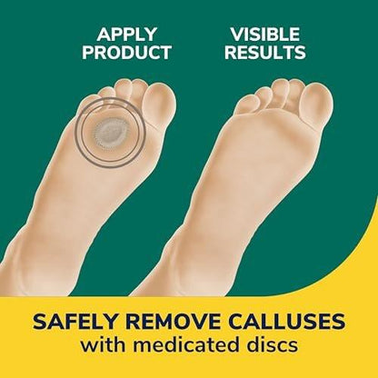 Dr. Scholl's Extra Dicke Hornhautentferner, 4 Stück // Hilft, harte Hornhaut zu erweichen und polstert für ganztägige Schmerzlinderung