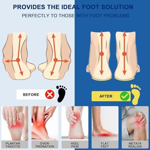 Plantarfasziitis Einlagen, Hohe Fußgewölbeunterstützung Schuheinlagen für Männer Frauen, Orthopädische Gel-Lauf-Einlagen für Plattfüße - Fußgewölbeschmerz - Pronation - Metatarsalgie Schmerzlinderung Schwere Unterstützung (Zuschneidbar)