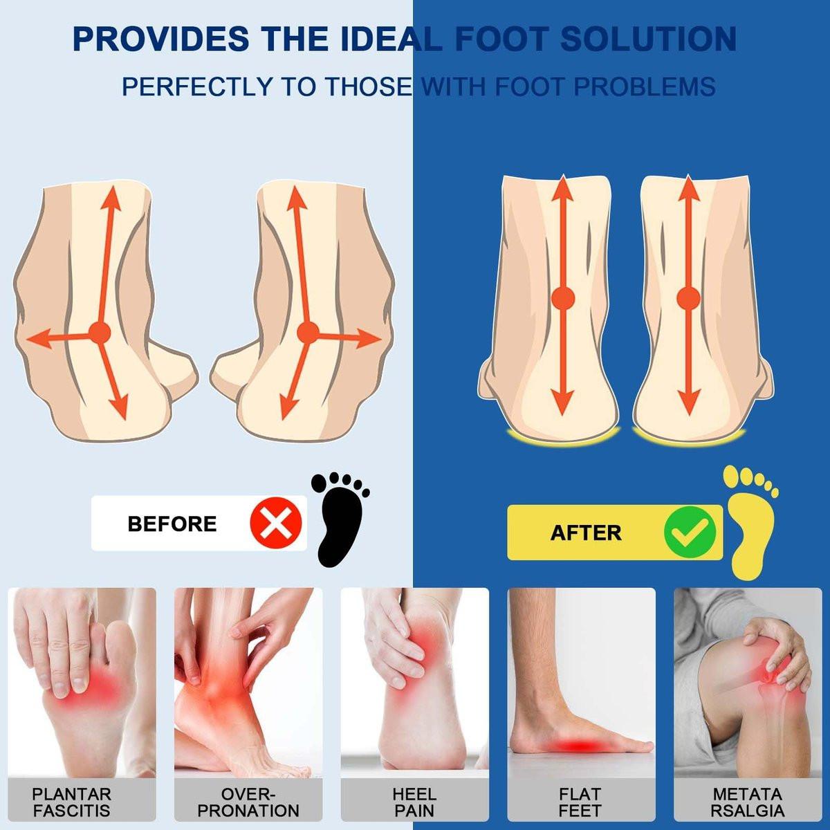 Plantarfasziitis Einlagen, Hohe Fußgewölbeunterstützung Schuheinlagen für Männer Frauen, Orthopädische Gel-Lauf-Einlagen für Plattfüße - Fußgewölbeschmerz - Pronation - Metatarsalgie Schmerzlinderung Schwere Unterstützung (Zuschneidbar)