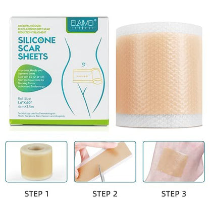 Medizinisches Silikon-Pflaster für Narben, Silikon-Narbenband (1,6" x 60"), Narbenentfernungsstreifen für Aknenarben, Kaiserschnitt- und Keloid-Narben – 6-8 Monate Vorrat