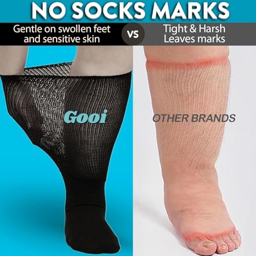 Gooi Extra Weite Socken für geschwollene Füße, weiche Dehnung bis 30 Zoll, Senioren, Diabetiker, Männer Frauen 10-13 13-15, nicht einschnürend, lockere Passform, Ödeme, Lymphödem, Neuropathie, bariatrisch, Gipsverband, über der Wade, Plus Size