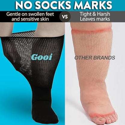 Gooi Extra Weite Socken für geschwollene Füße, weiche Dehnung bis 30 Zoll, Senioren, Diabetiker, Männer Frauen 10-13 13-15, nicht einschnürend, lockere Passform, Ödeme, Lymphödem, Neuropathie, bariatrisch, Gipsverband, über der Wade, Plus Size