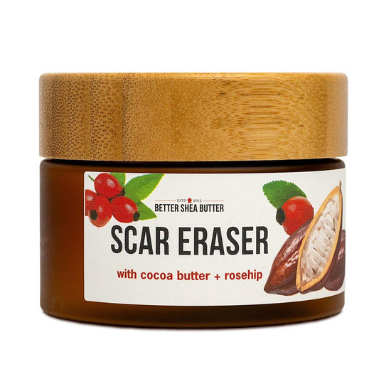 Better Shea Butter Scar Eraser Balm – Kakaobutter-Creme für Dehnungsstreifen und dunkle Flecken, Verbrennungen, alte Narben – Aknenarben – Mit null synthetischen Inhaltsstoffen, 113 g