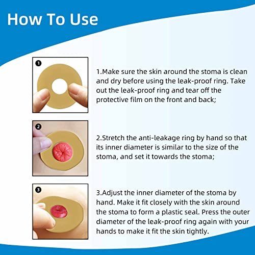 10 Stück Ostomy-Barriereringe, stichfrei, formbar, Hydrokolloid-Hautverlängerungsringe für Kolostomiebeutel