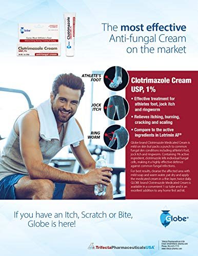 Globe Clotrimazol Antimykotikum Creme 1% USP, 1 Unze (4er-Pack) – Behandlung gegen Fußpilz, Juckreiz, Brennen, Risse und Schuppen bei Athletenfuß, Jock Itch, Ringelflechte und mehr