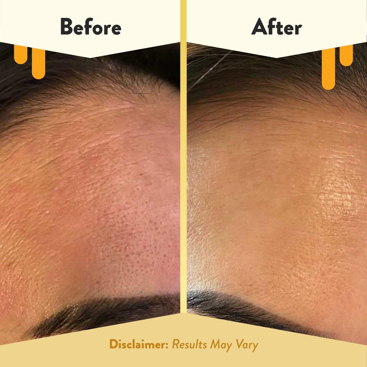 ECZEMA HONEY Nährendes Gesichtsserum – Tägliches Feuchtigkeitsserum – Gesichtsöl für Ekzeme, trockene & empfindliche Haut (30 ml)
