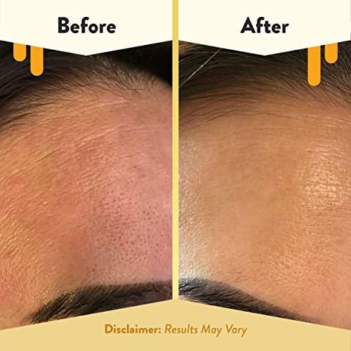 ECZEMA HONEY Nährendes Gesichtsserum – Tägliches Feuchtigkeitsserum – Gesichtsöl für Ekzeme, trockene & empfindliche Haut (30 ml)